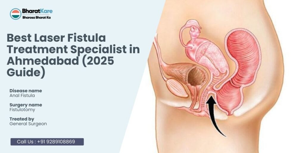 Laser Fistula Treatment Specialist in Ahmedabad