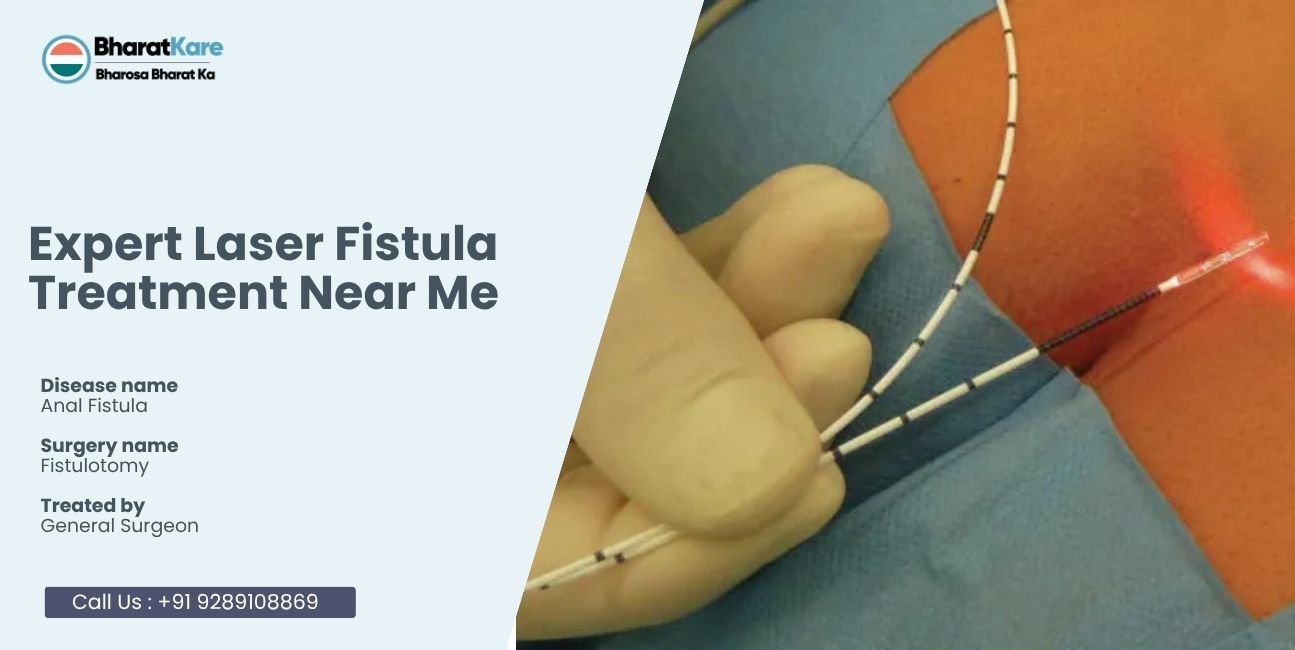 Expert Laser Fistula Treatment Near Me
