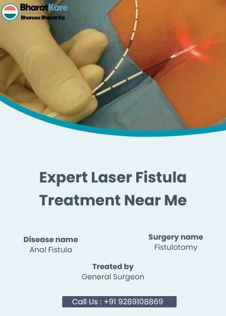 Expert Laser Fistula Treatment Near Me