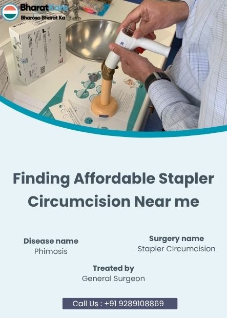 Finding Affordable Stapler Circumcision Near me