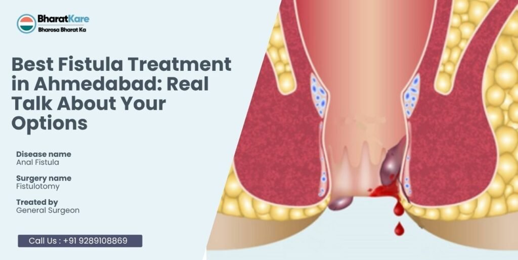 Best Fistula Treatment in Ahmedabad: Real Talk About Your Options
