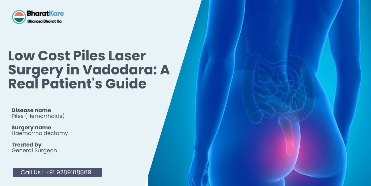 Low Cost Piles Laser Surgery in Vadodara