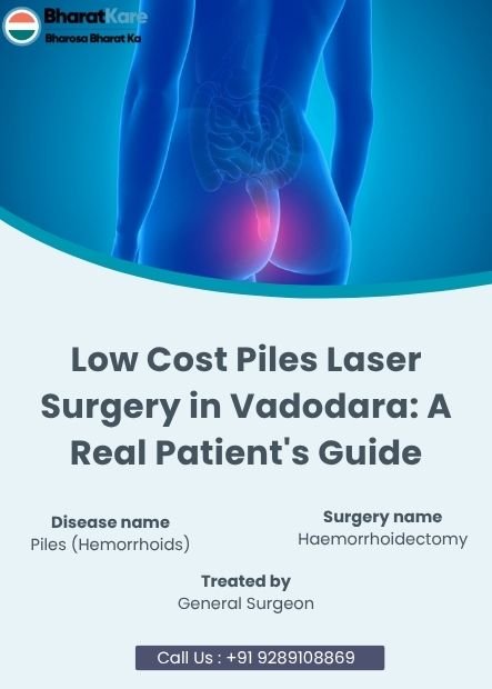 Low Cost Piles Laser Surgery in Vadodara