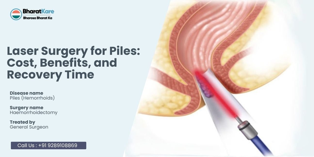 Laser Surgery for Piles: Cost, Benefits, and Recovery Time