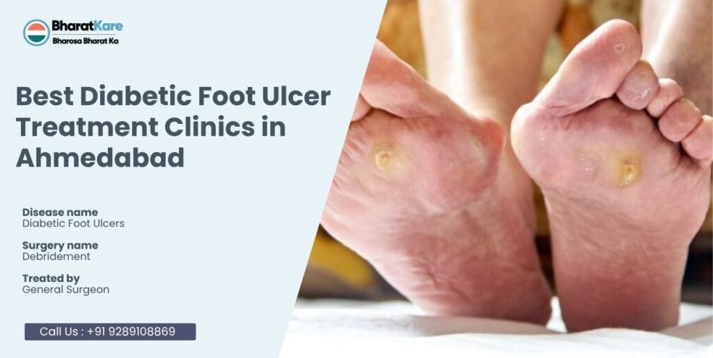 Best Diabetic Foot Ulcer Treatment
