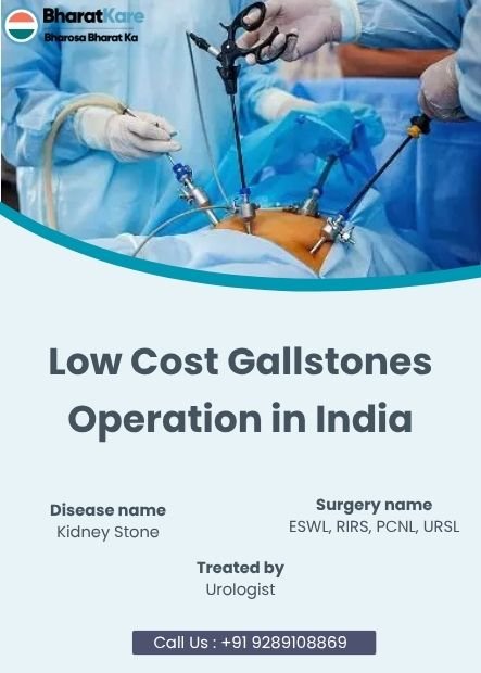 Gallstone Treatment in Vadodara 1