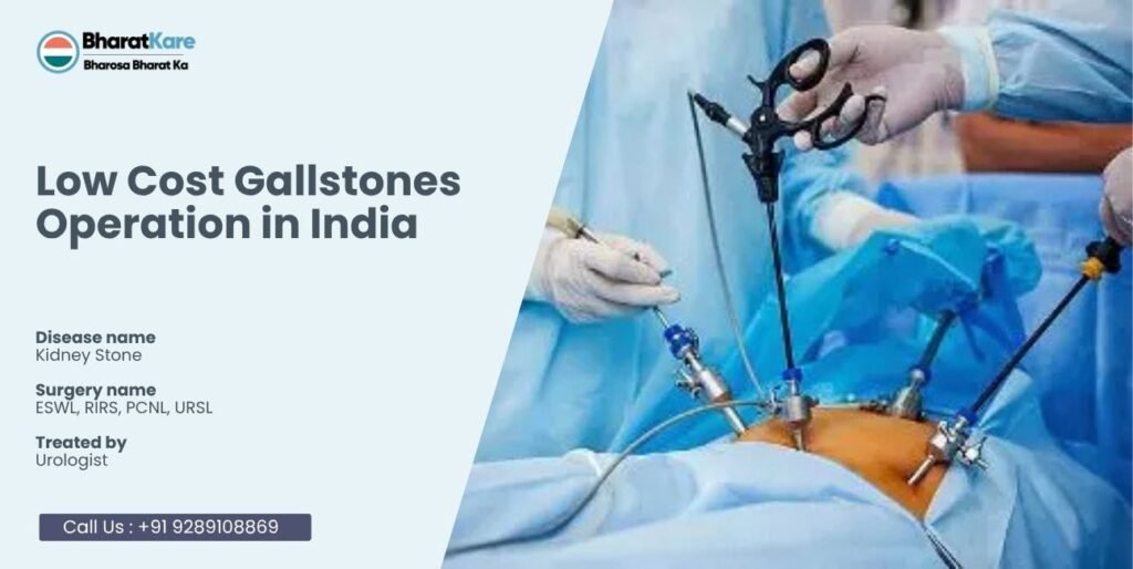 Gallstone Treatment in Vadodara