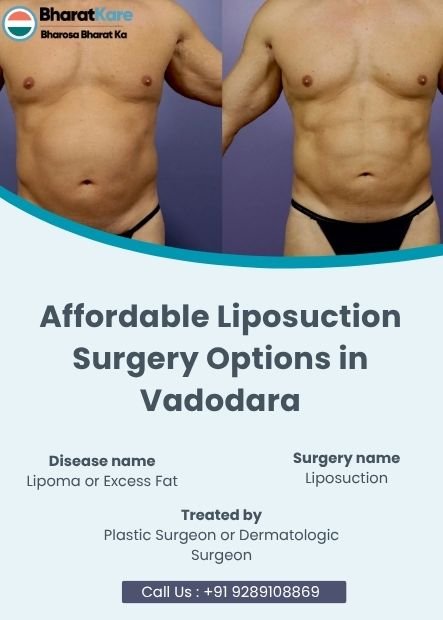 Affordable Liposuction Surgery Options in Vadodara