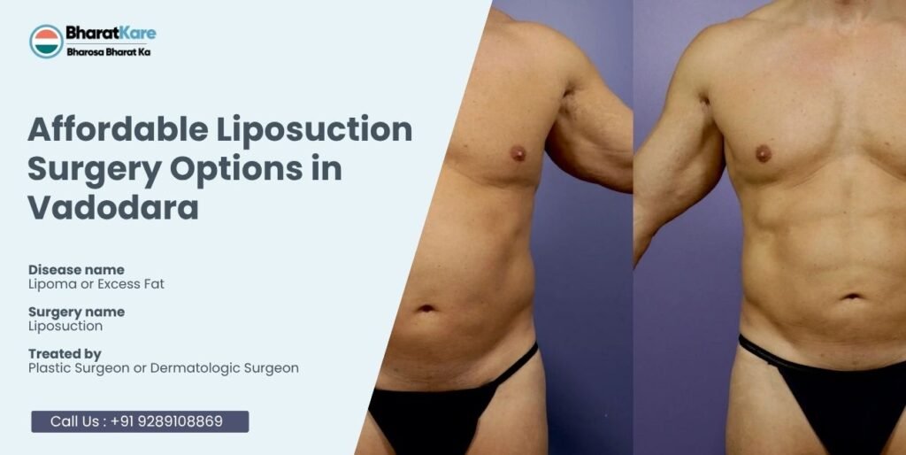 Affordable Liposuction Surgery Options in Vadodara