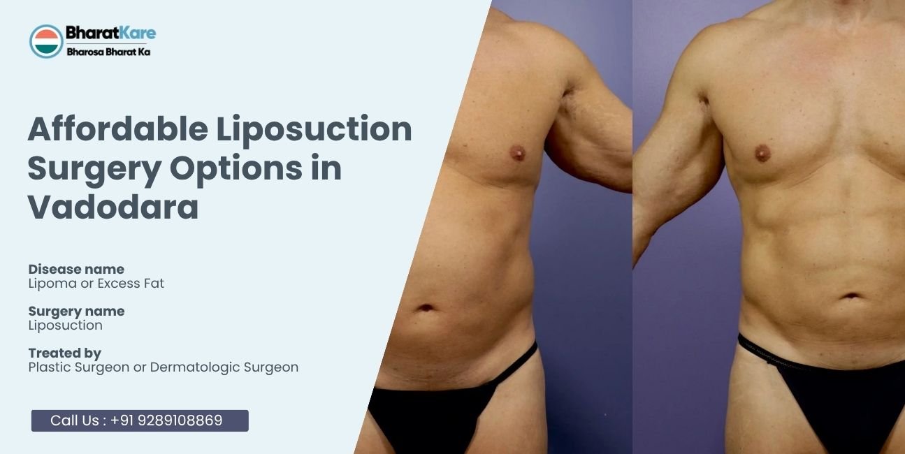 Affordable Liposuction Surgery Options in Vadodara