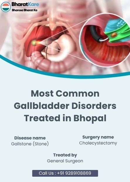 Gallbladder Disorders Treated in Bhopal
