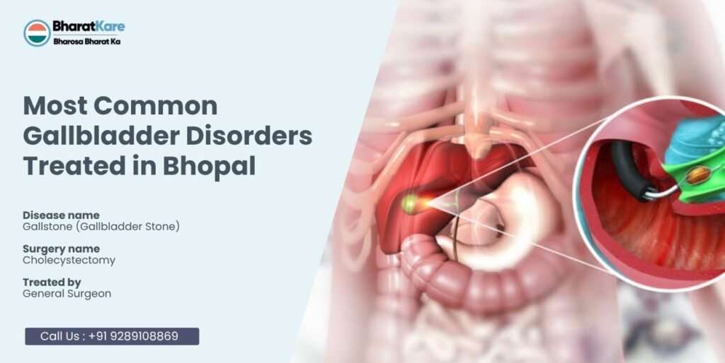 Gallbladder Disorders Treated in Bhopal