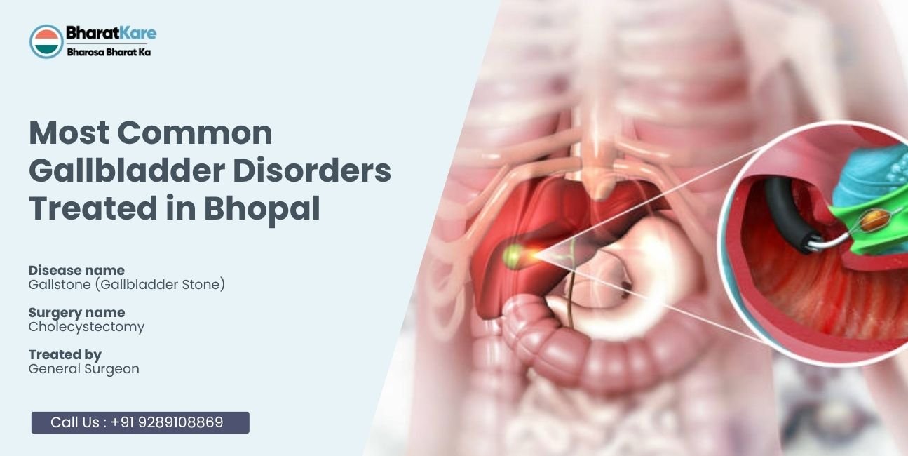 Gallbladder Disorders Treated in Bhopal