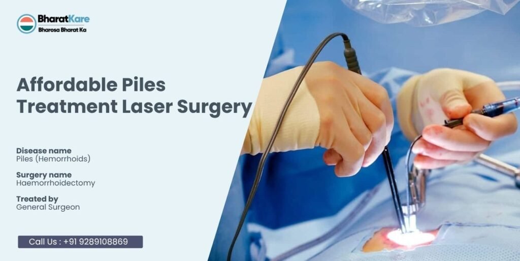 Affordable Piles Treatment Laser Surgery