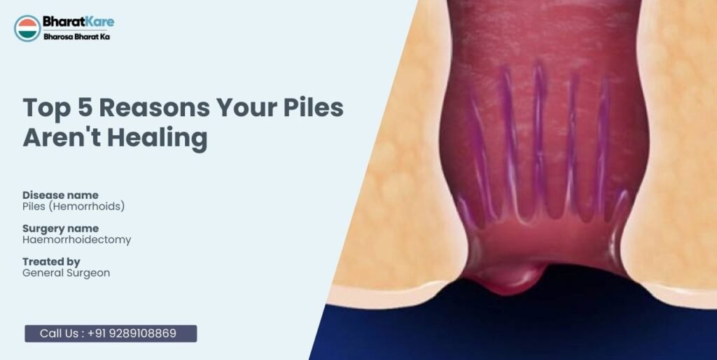 Top 5 Reasons Your Piles Aren't Healing
