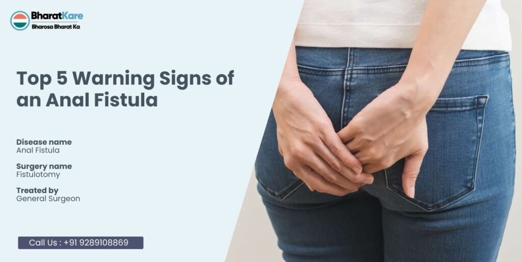 Top 5 Warning Signs of an Anal Fistula