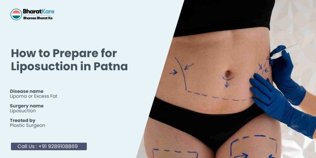 Prepare for Liposuction in Patna