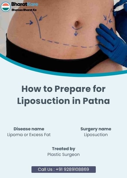 Prepare for Liposuction in Patna