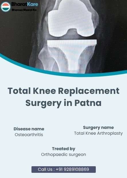 Knee Replacement Surgery in Patna