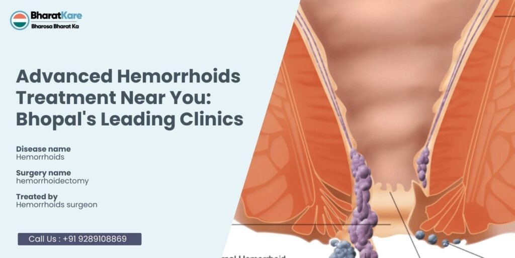 Advanced Hemorrhoids Treatment Near You