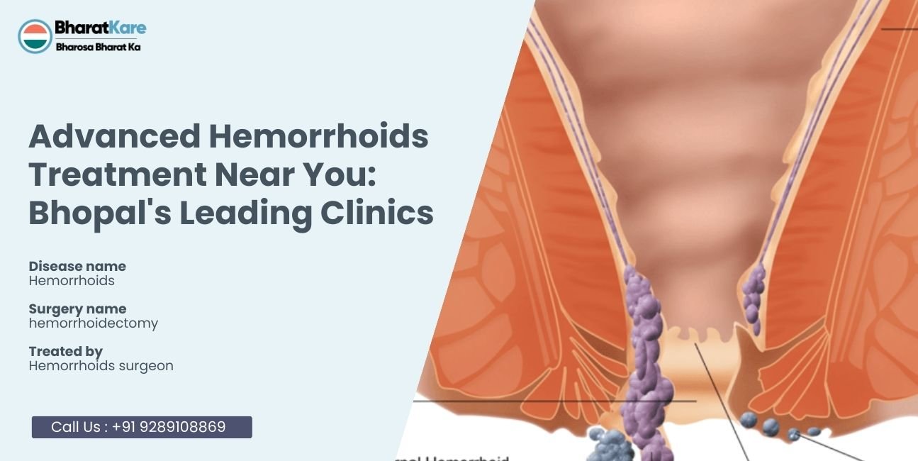 Advanced Hemorrhoids Treatment Near You