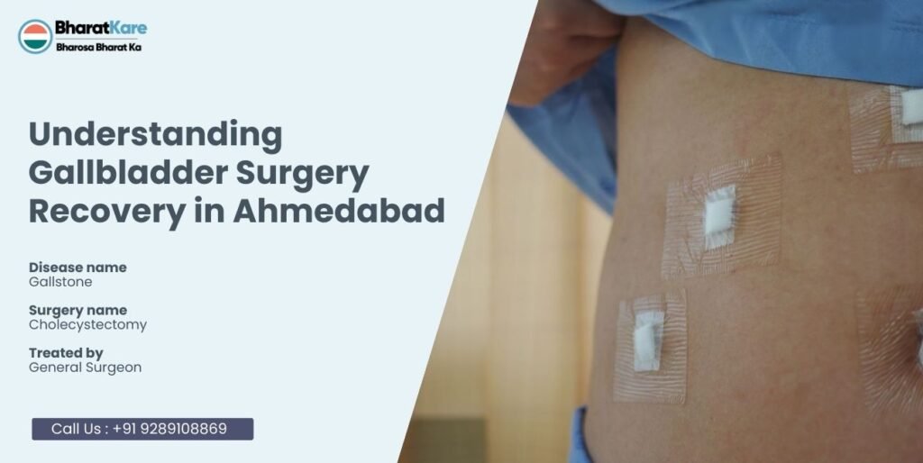 Gallbladder Surgery Recovery in Ahmedabad