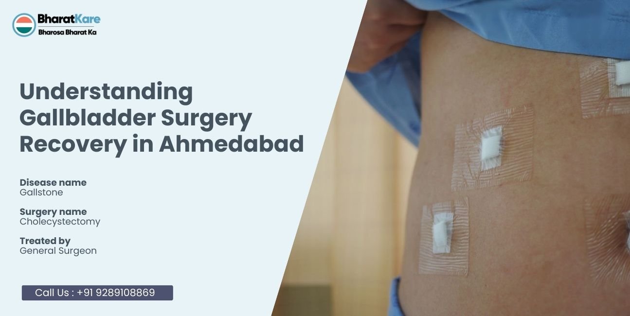 Gallbladder Surgery Recovery in Ahmedabad