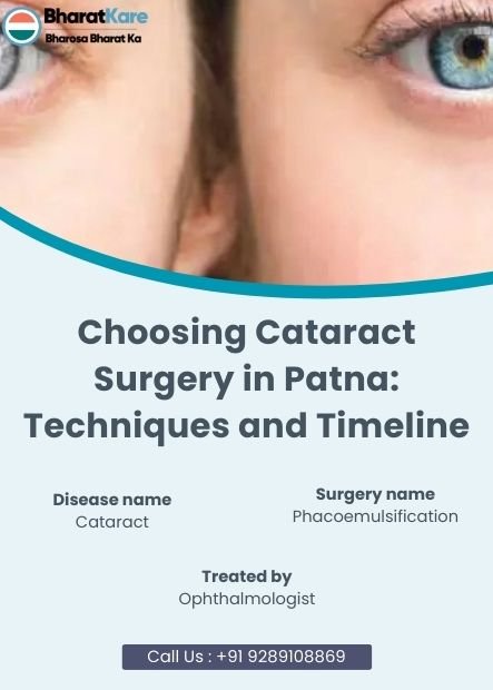 Choosing Cataract Surgery in Patna