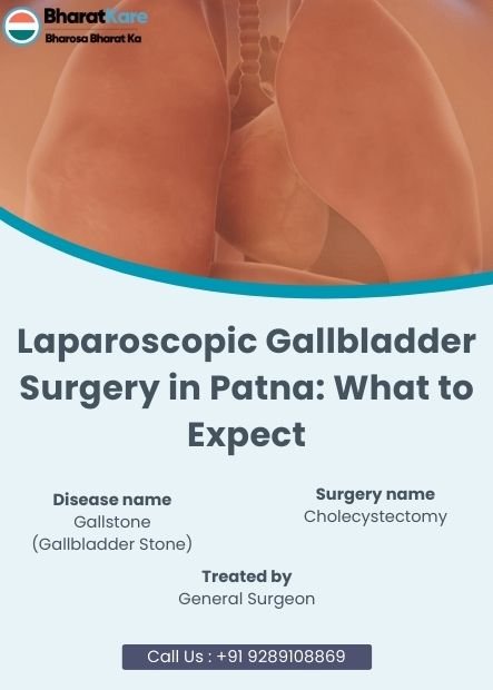 Laparoscopic Gallbladder Surgery in Patna
