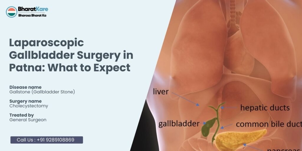 Laparoscopic Gallbladder Surgery in Patna