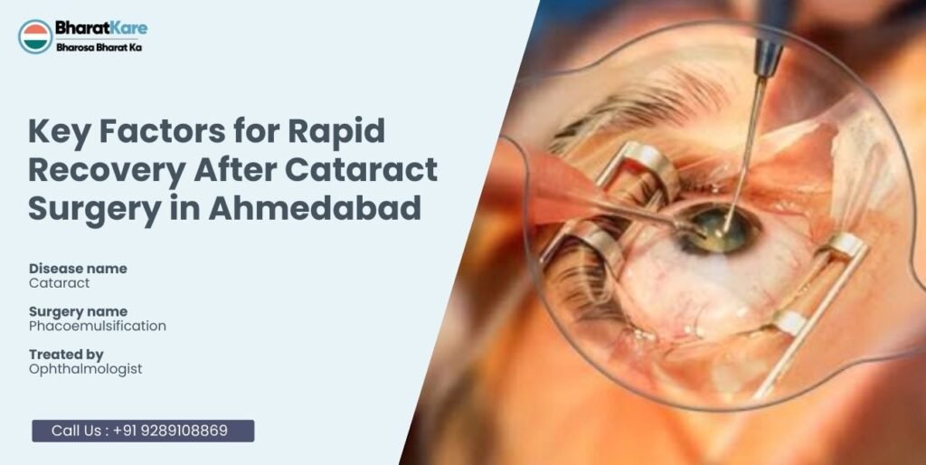 Rapid Recovery After Cataract Surgery in Ahmedabad