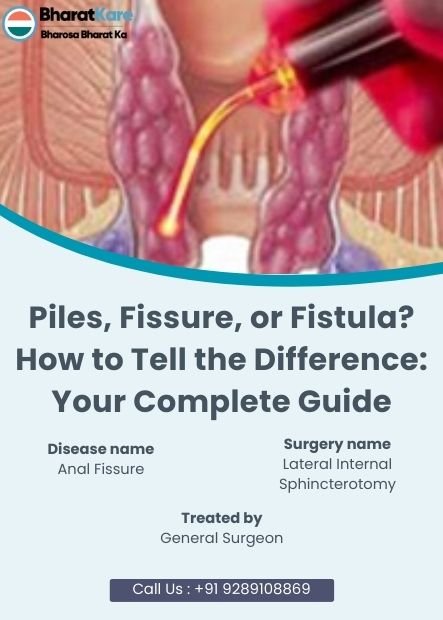 Piles Treatment
