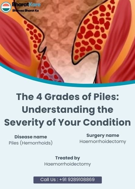 4 Grades of Piles