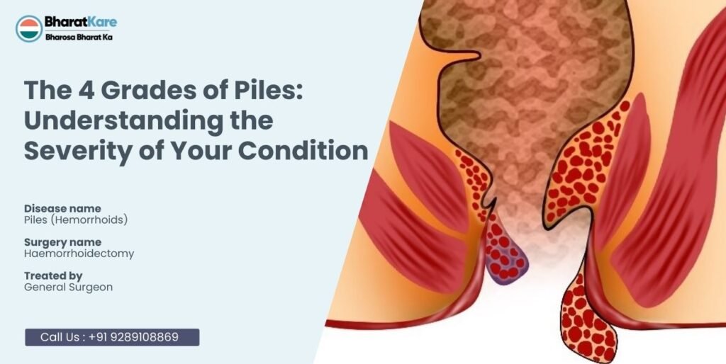 4 Grades of Piles