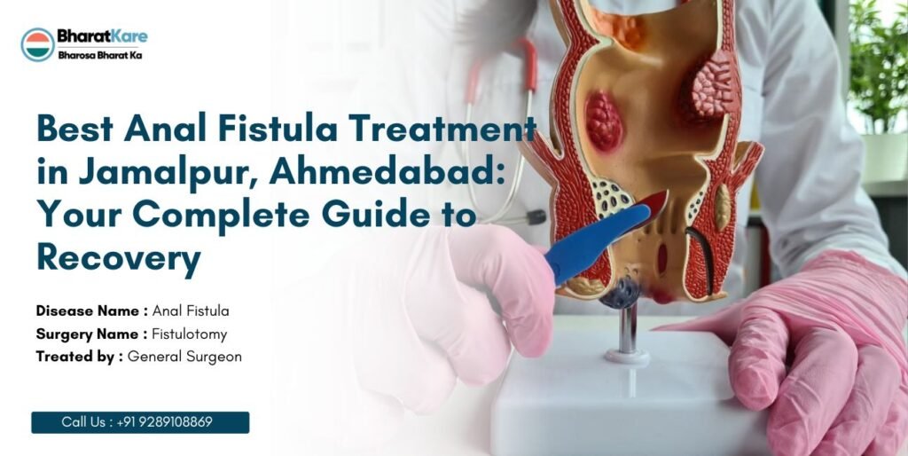 Anal Fistula Treatment in Jamalpur