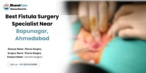 Best Fistula Surgery Specialist Near Bapunagar, Ahmedabad