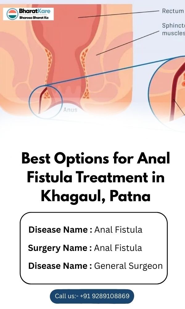 Best Options for Anal Fistula Treatment in Khagaul, Patna (1)