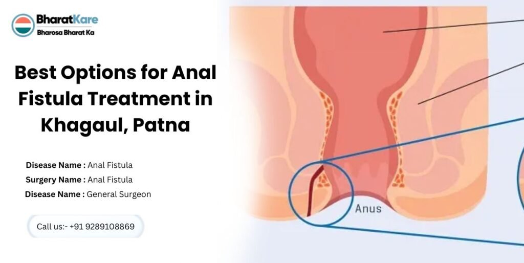Best Options for Anal Fistula Treatment in Khagaul, Patna