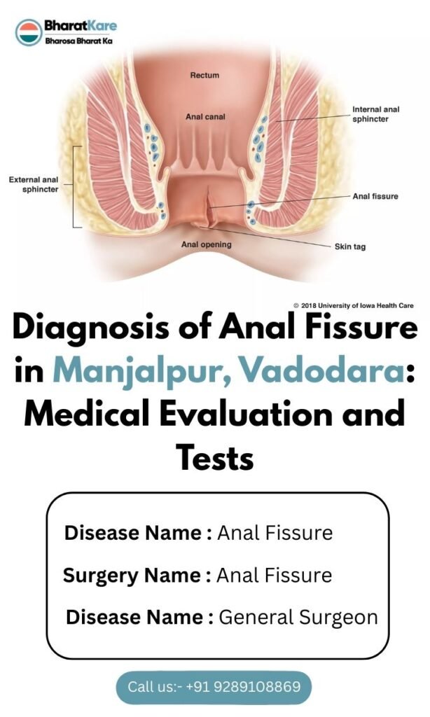 Diagnosis of Anal Fissure in Manjalpur, Vadodara Medical Evaluation and Tests (1)