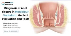Diagnosis of Anal Fissure in Manjalpur, Vadodara: Medical Evaluation and Tests