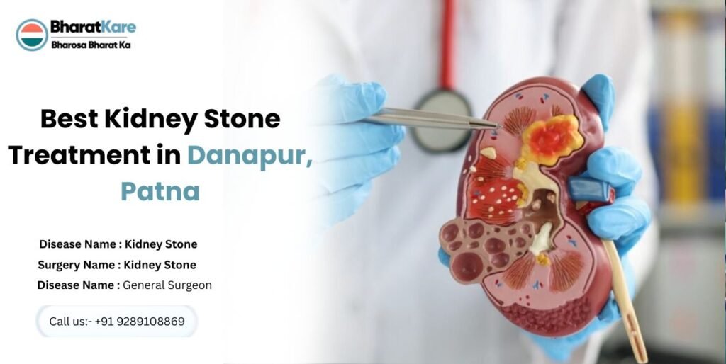 Best Kidney Stone Treatment in Danapur, Patna