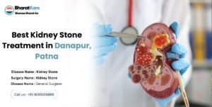 Best Kidney Stone Treatment in Danapur, Patna