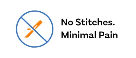 No Stiches