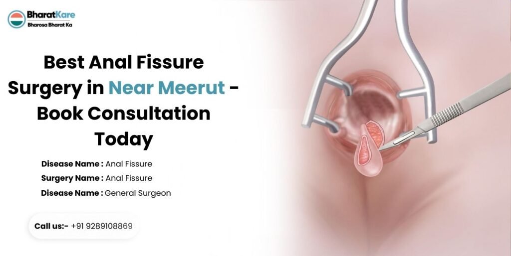 Best Anal Fissure Surgery in Near Meerut Book Consultation Today