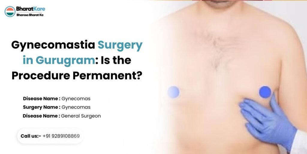 Gynecomastia Surgery in Gurugram: Is the Procedure Permanent?