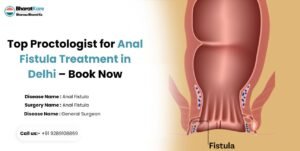 Top Proctologist for Anal Fistula Treatment in Delhi – Book Now