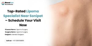 Top-Rated Lipoma Specialist Near Sonipat – Schedule Your Visit Now